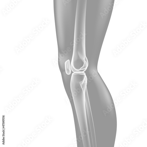 Kniegelenk - Röntgenbild - 3D Grafik