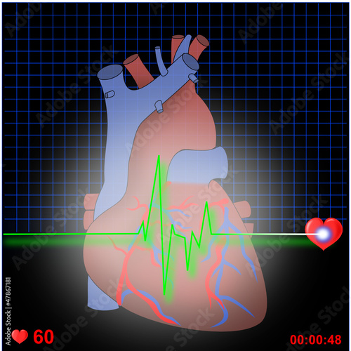 Herz EKG