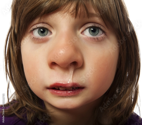 runny nose - cold - ill little girl - funny concept Stock Photo | Adobe  Stock