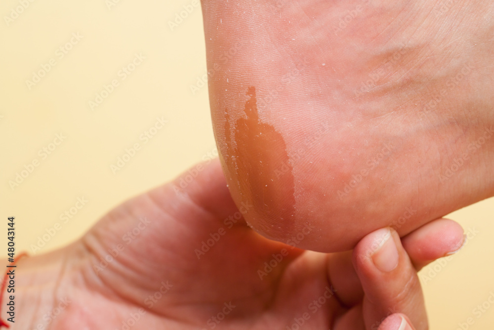Pedicure procedure Pedicure procedure