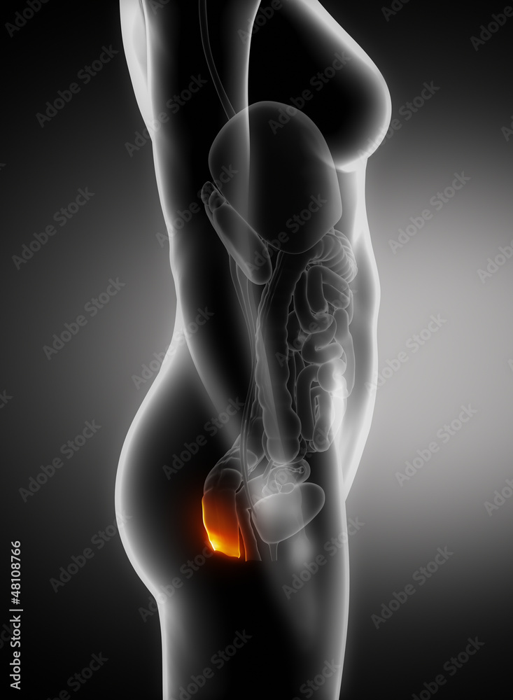 Hemorrhoids problem concept Hemorrhoids problem concept