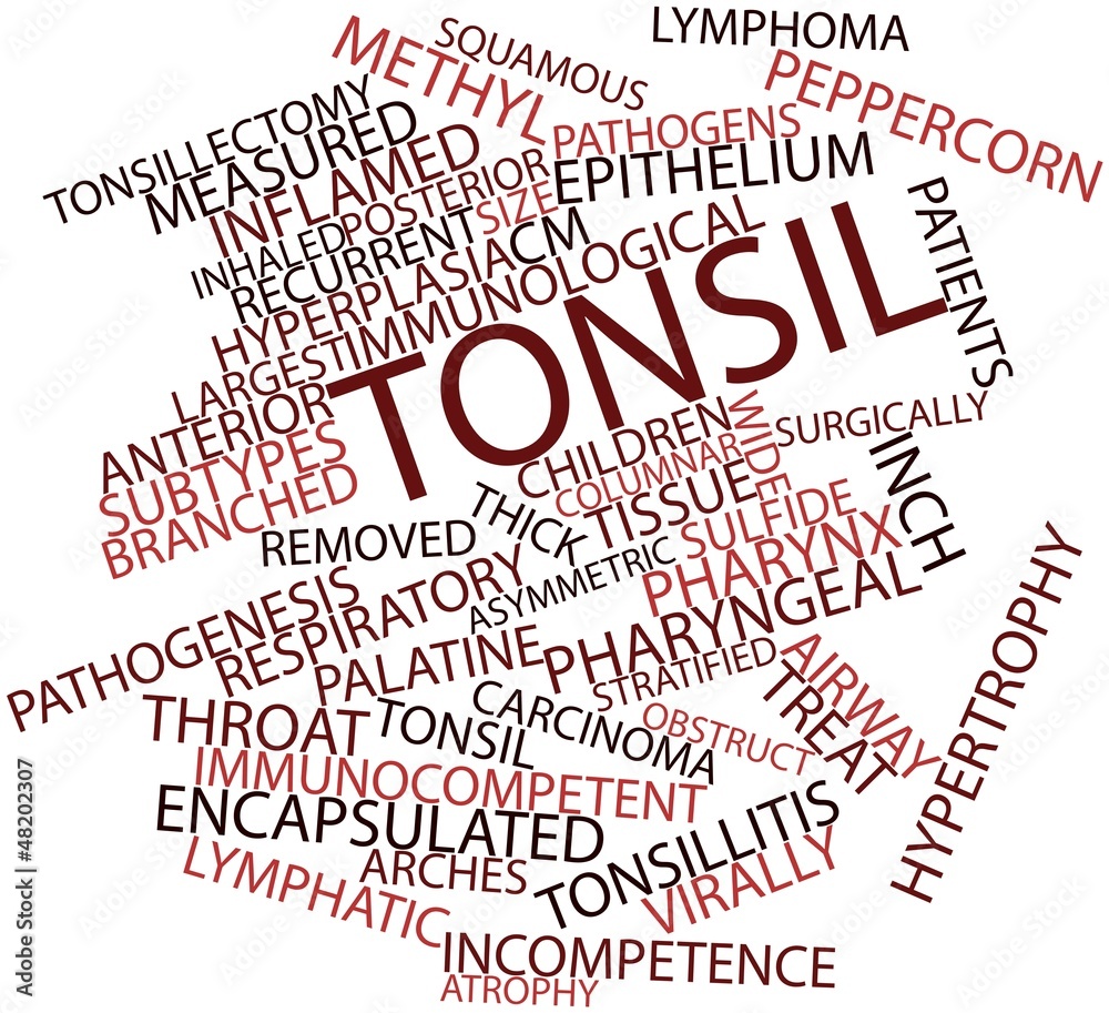 Word cloud for Tonsil