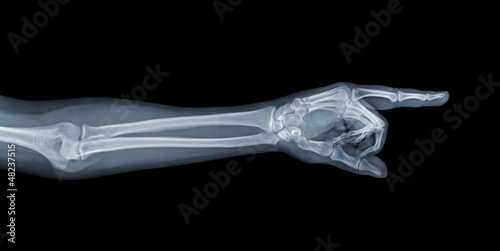 Fotografie Pointing X-ray hand
