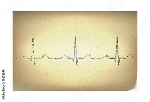 ECG on the old paper