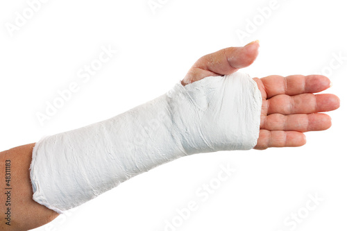 Broken arm with a plaster cast isolated on white