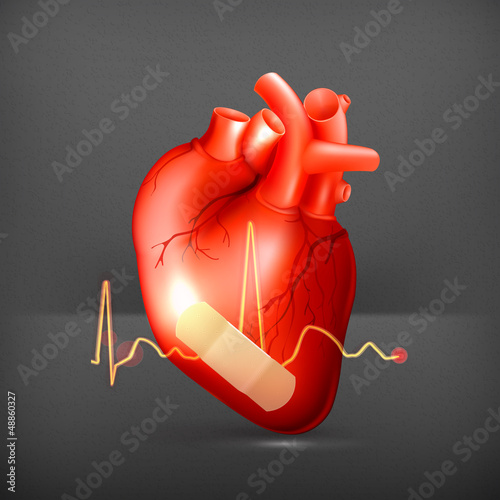 Damaged heart