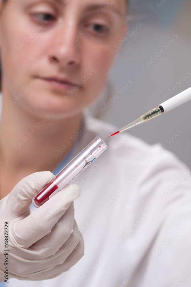 Micro pipette with blood Micro pipette with blood