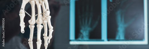 röntgenbild von einer hand photo