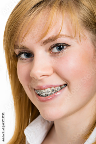 Beautiful young woman with brackets on teeth