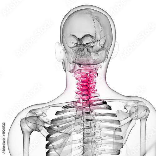 3d rendered illustration of a painful neck photo