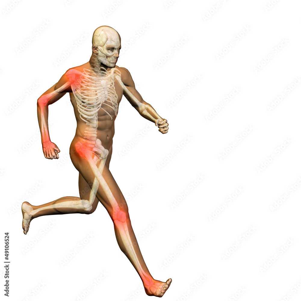 High resolution conceptual 3D human with inflammation