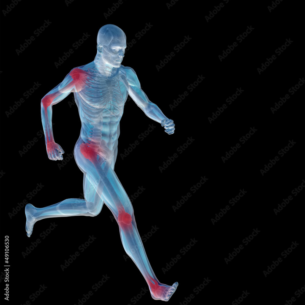 High resolution conceptual 3D human with inflammation High resolution conceptual 3D human with inflammation