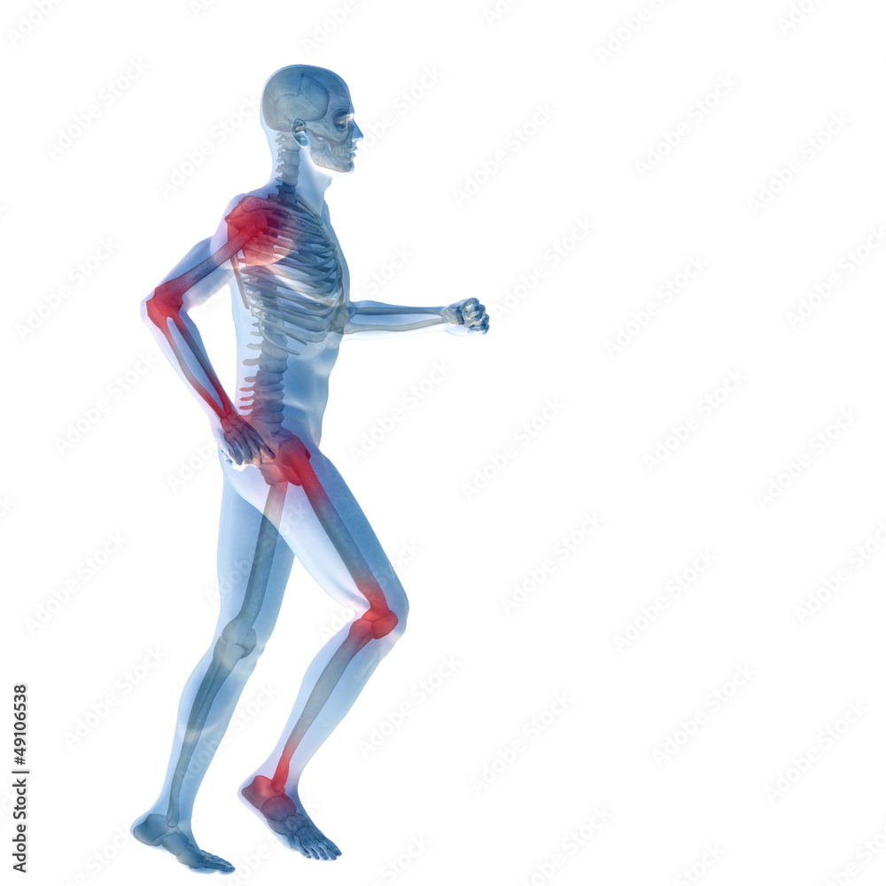 High resolution conceptual 3D human with inflammation High resolution conceptual 3D human with inflammation