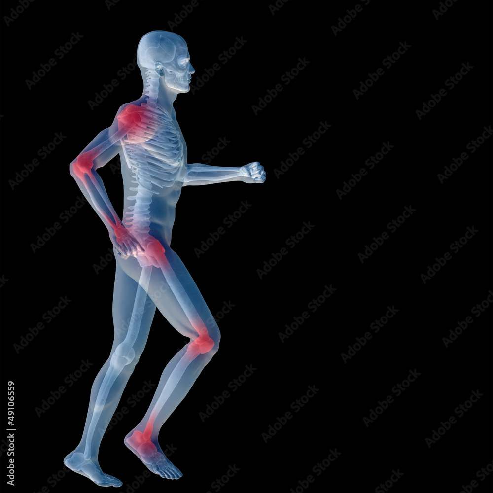 High resolution conceptual 3D human with inflammation