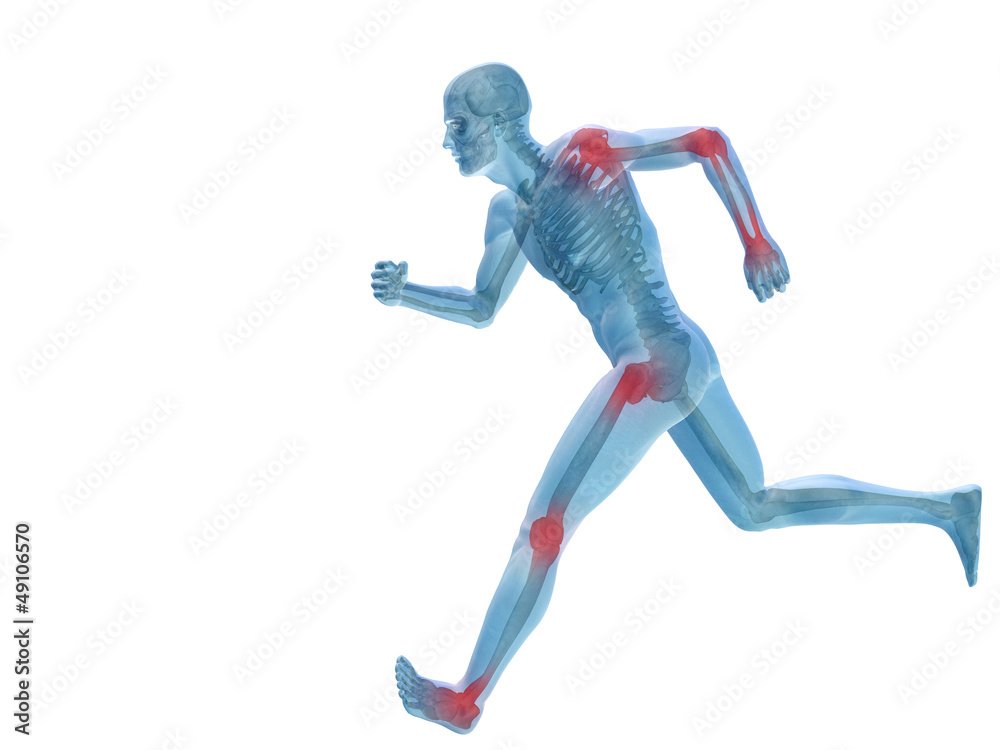 High resolution conceptual 3D human with inflammation High resolution conceptual 3D human with inflammation