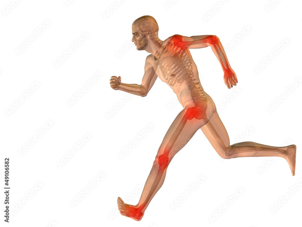High resolution conceptual 3D human with inflammation High resolution conceptual 3D human with inflammation