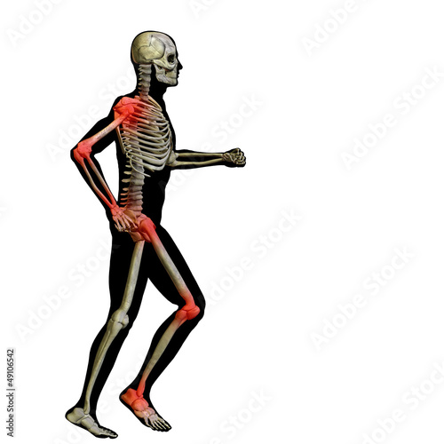 High resolution conceptual 3D human with inflammation