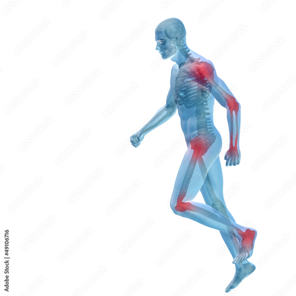 High resolution conceptual 3D human with inflammation High resolution conceptual 3D human with inflammation