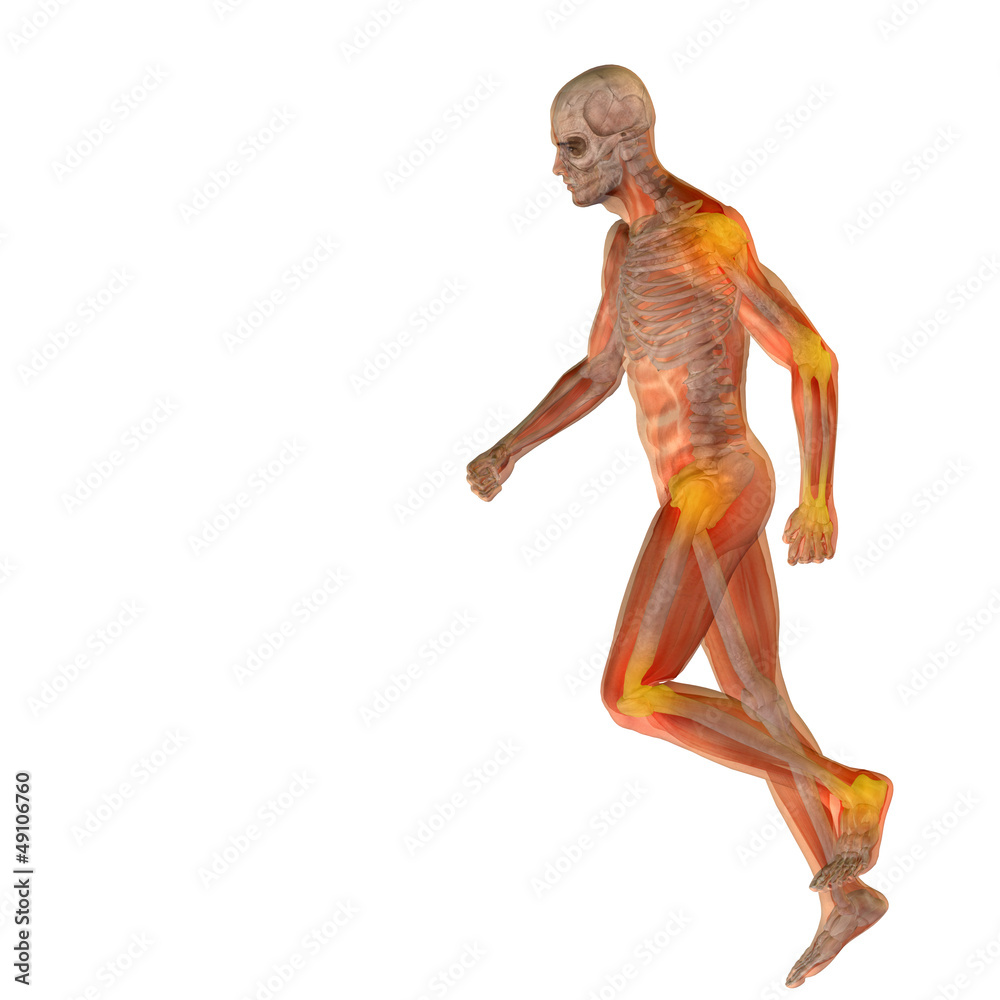 High resolution conceptual 3D human with inflammation High resolution conceptual 3D human with inflammation