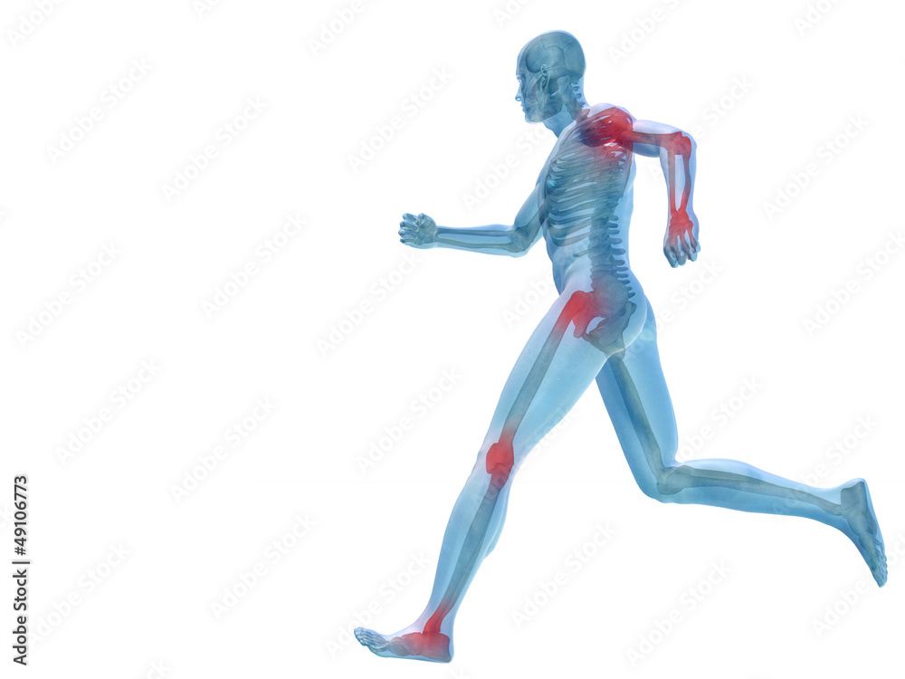 High resolution conceptual 3D human with inflammation High resolution conceptual 3D human with inflammation