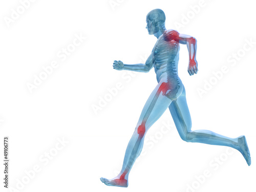 High resolution conceptual 3D human with inflammation © high_resolution