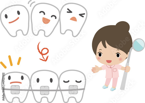 歯列矯正のイメージ