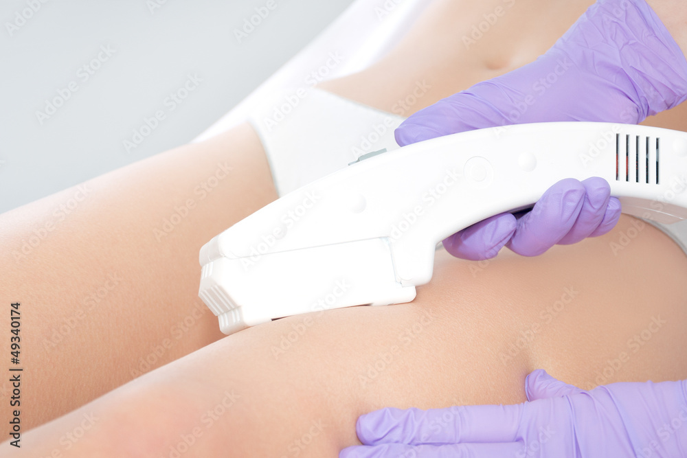 Naklejka premium Close up of laser epilation treatment