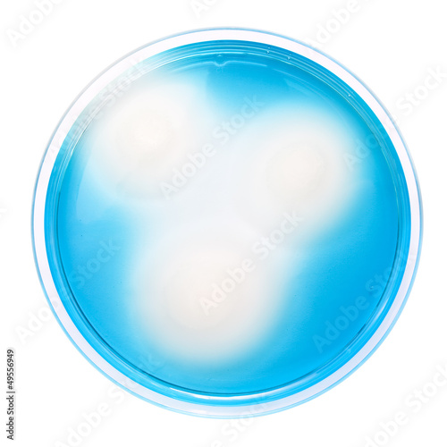 Salmonella colonies on MSRV agar plate