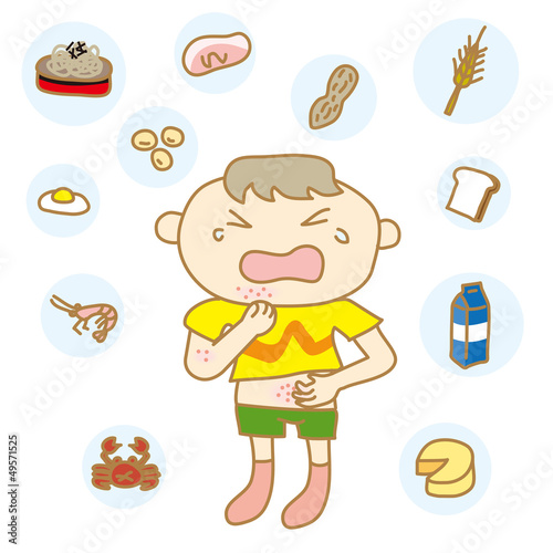 食物アレルギーの子ども