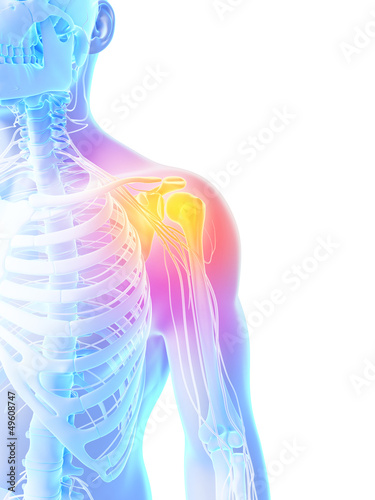 3d rendered illustration - painful shoulder