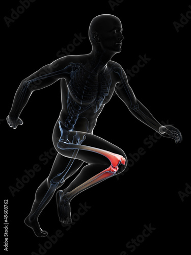 3d rendered illustration - painful runner joints