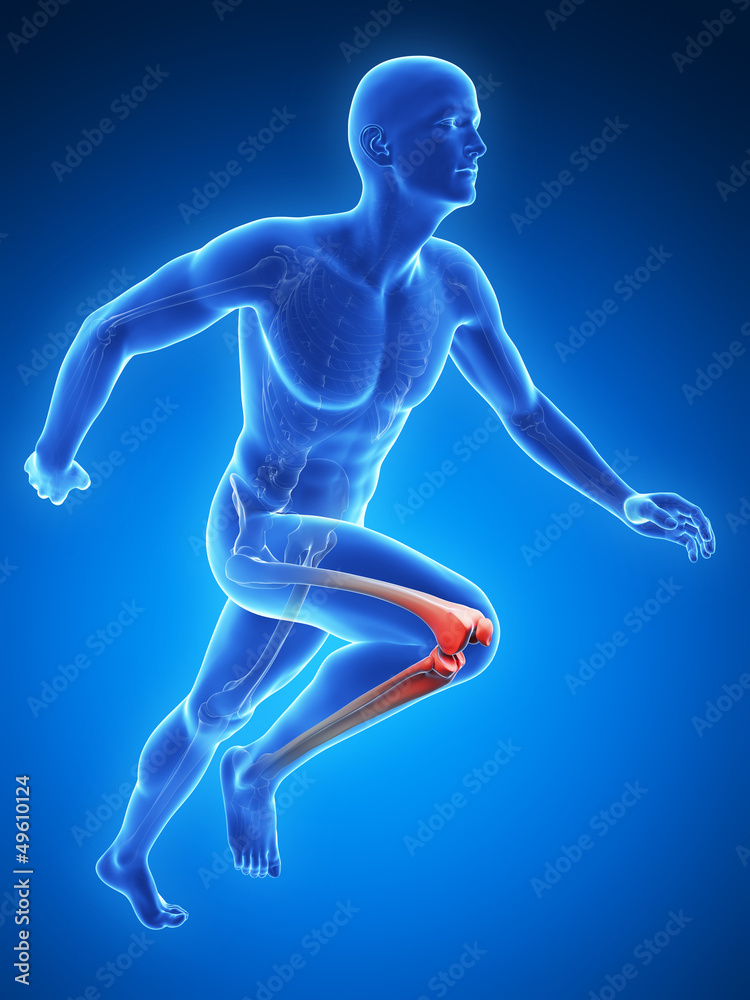 3d rendered illustration - painful knee