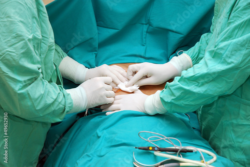 Obraz na płótnie Breast augmentation surgery