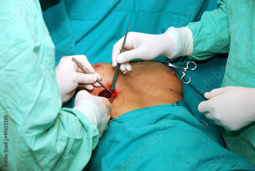 Naklejka Breast augmentation surgery