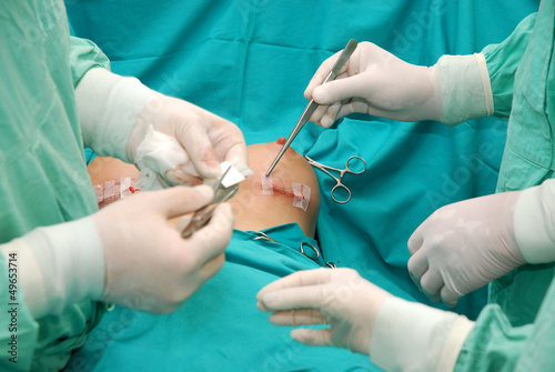 Plakat w ramie Breast augmentation surgery
