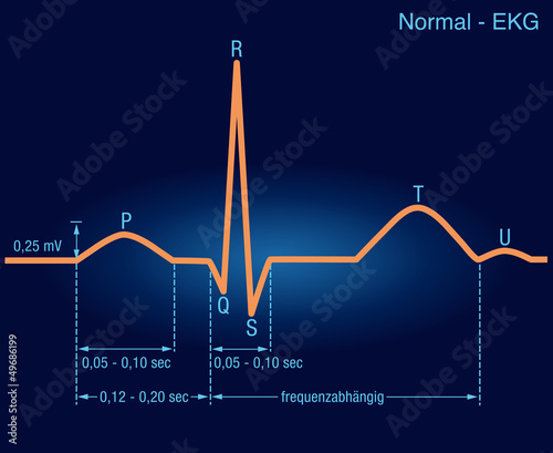 EKG-Kurve / normale