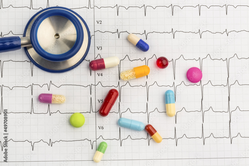 Stethoskop und Tabletten auf einem EKG Stethoskop und Tabletten auf einem EKG