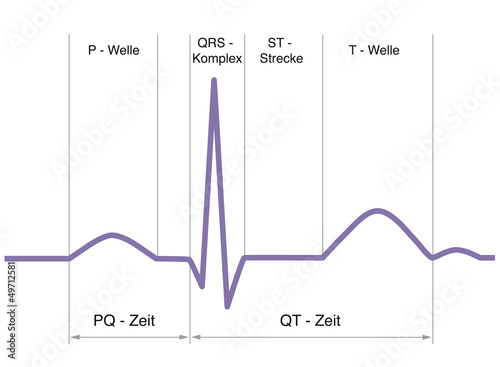 EKG-Kurve vor weiß, mit Beschriftung