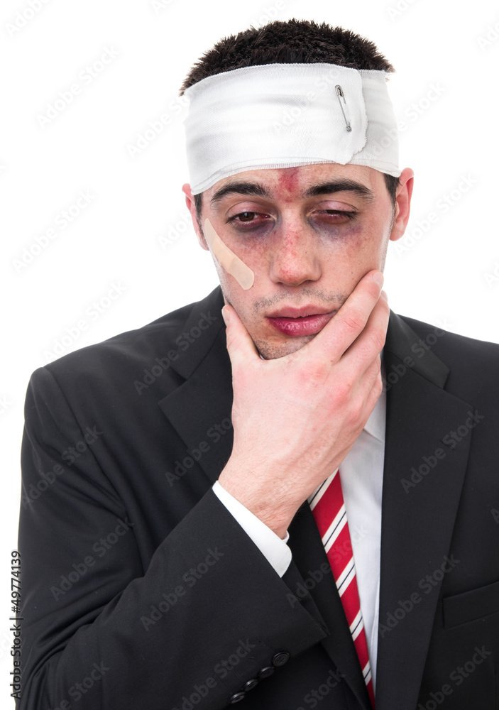 Man with bruised eyes and head, funny businessman