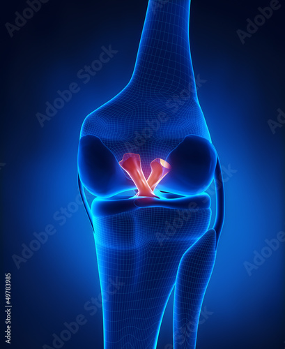 Tableau sur toile Anterior and Posterior Cruciate Ligament