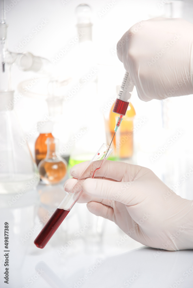 Doctor's hand in glove with blood Doctor's hand in glove with blood