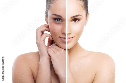 A split photo of a woman before and after retouch photo