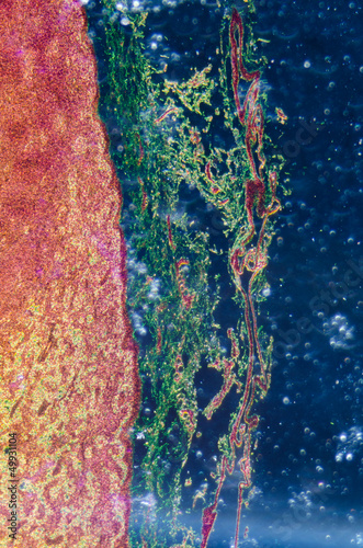 lymphatic node tissue