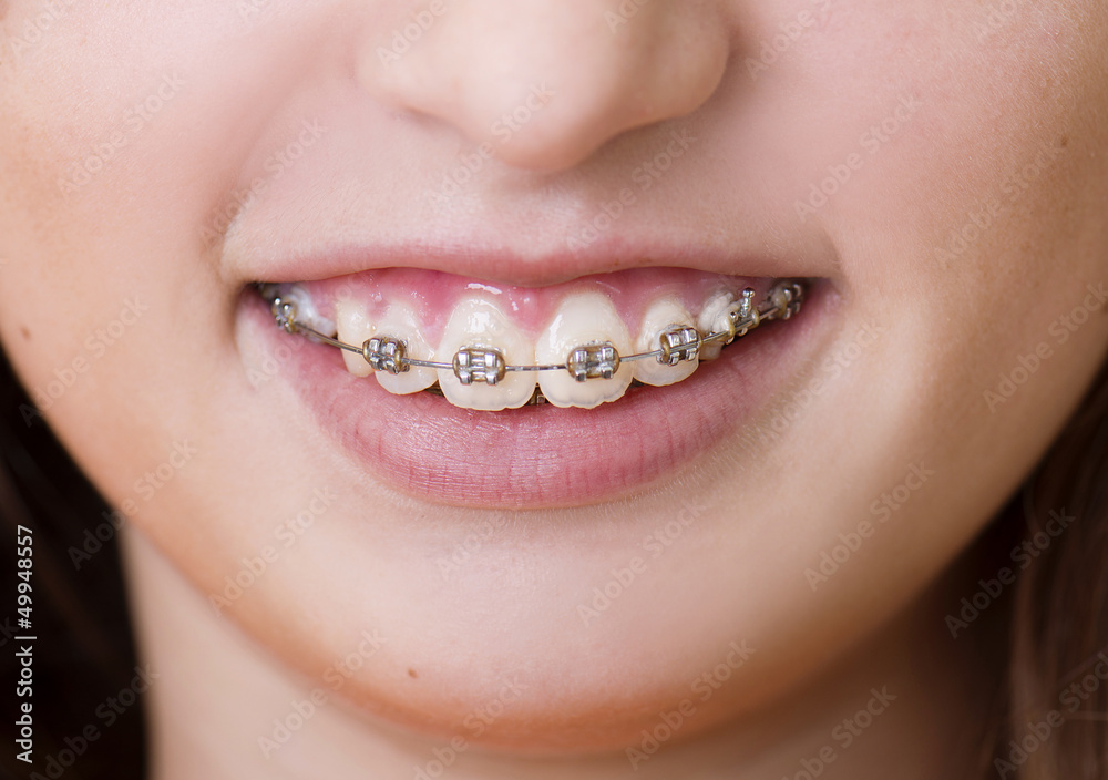 Obraz premium Dental visit