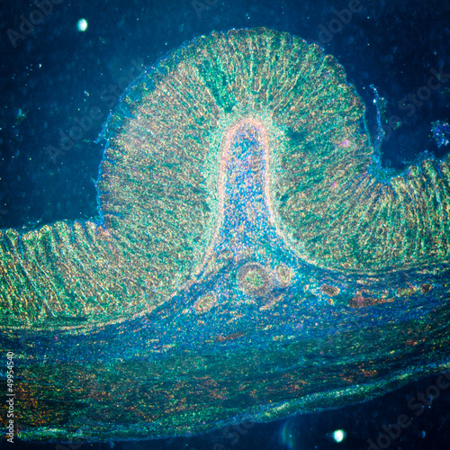 Billede på lærred micrograph of stomach tissue