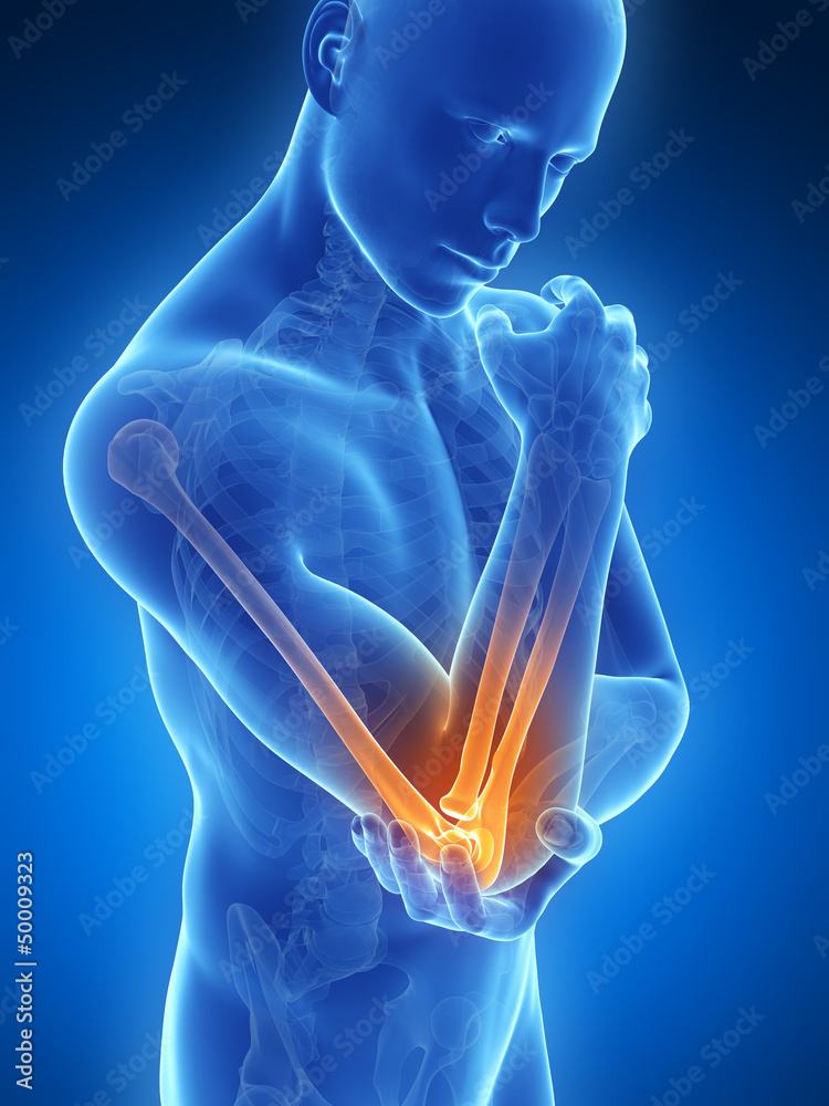 Wall Mural 3d rendered illustration of pain in the elbow