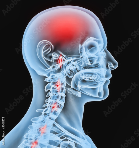 Radiografia cabeza