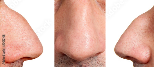 Aquiline nose photo