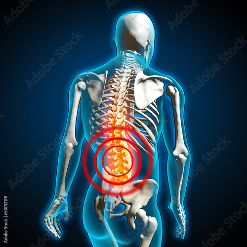 human back pain rückenschmerzen