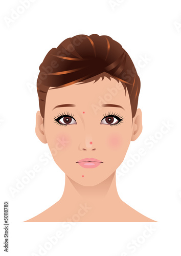 女性